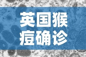 英国猴痘确诊病例增至57例/美国出现猴痘病毒