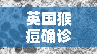 英国猴痘确诊病例增至57例/美国出现猴痘病毒